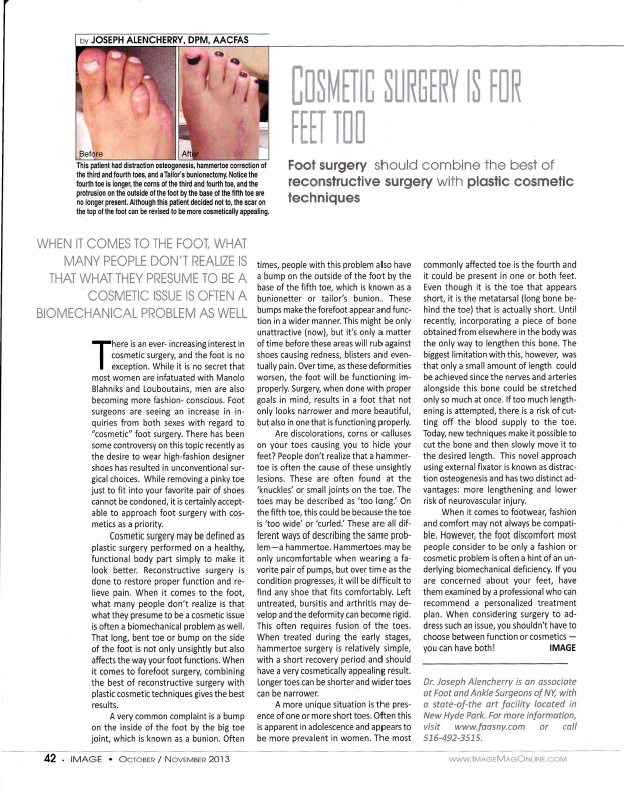 Aesthetic Fifth Toe Correction Surgery