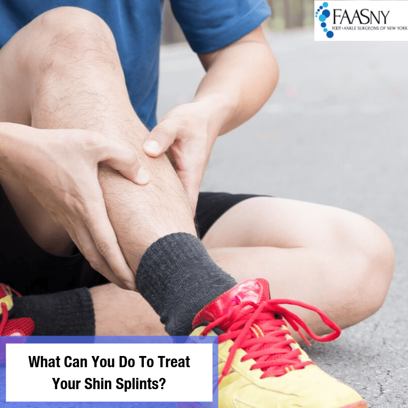 What can you do to treat your shin splints - FAASNY