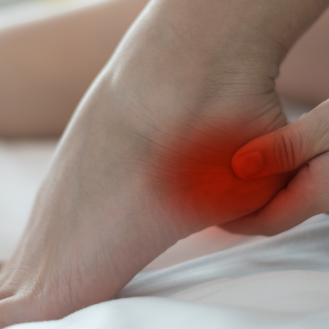 Achilles tendonitis vs. plantar fasciitis – How to tell the difference