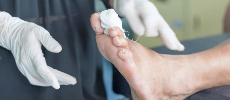 podiatrist on Long Island